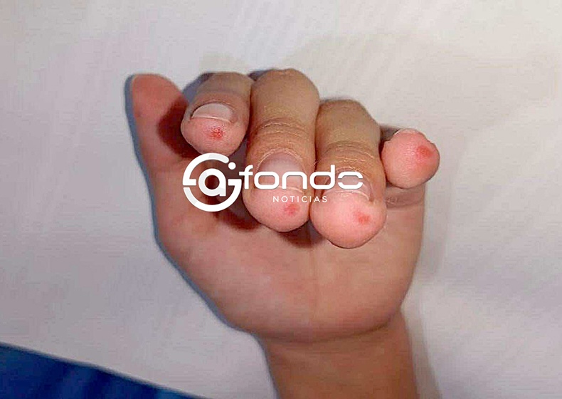 TORTURA. Maestra causa lesiones a alumnos de secundaria al obligarlos a lijarse los dedos de las manos