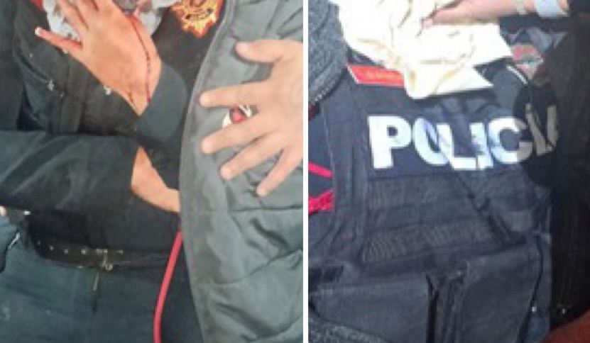 ATENCIÓN: Jefe de policía apuñala a una oficial y luego se corta él solo