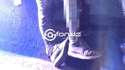 ACCIDENTE: Borracho agarró su motoneta y terminó con un pie destrozado