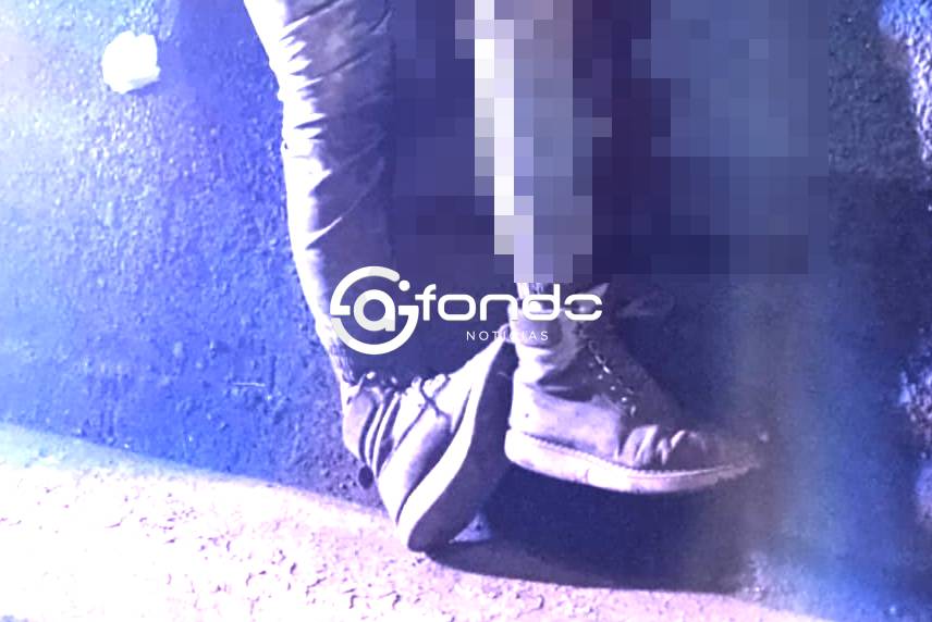 ACCIDENTE: Borracho agarró su motoneta y terminó con un pie destrozado